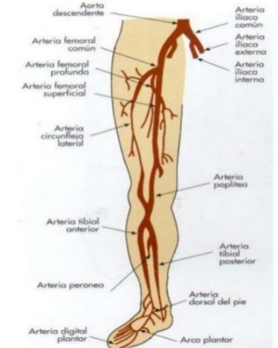 sectores afectados pie diabetico